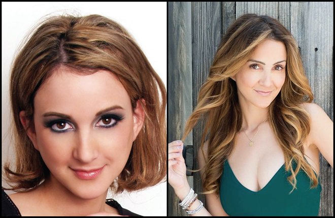 Androgenetic alopecia